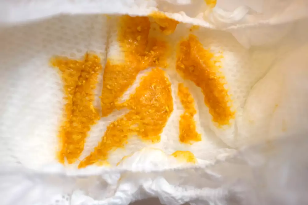 Gult bajs i en blöja. Fotografi.