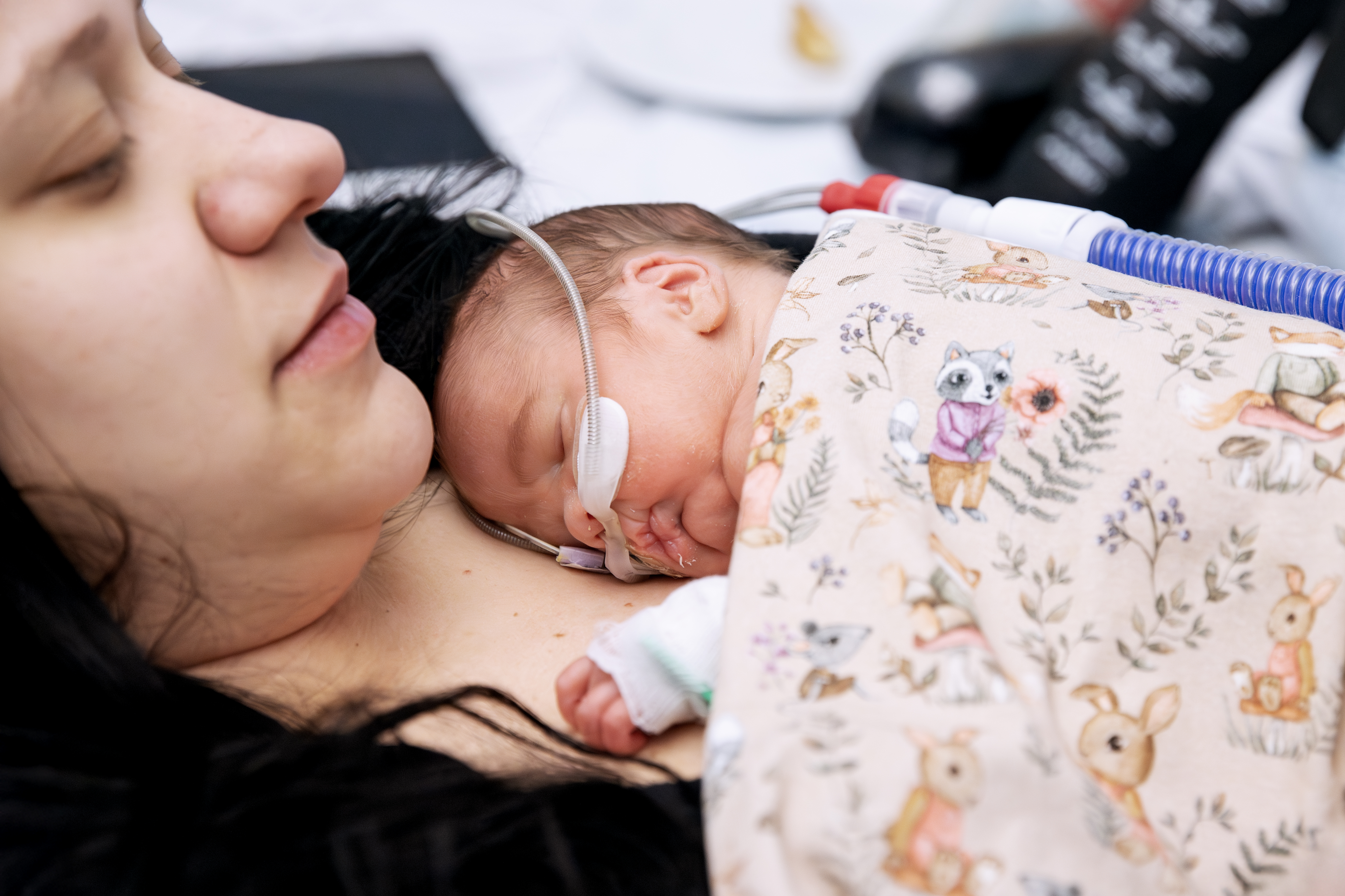 Förtidigt född bebis som ligger på bröstet hos sin förälder.