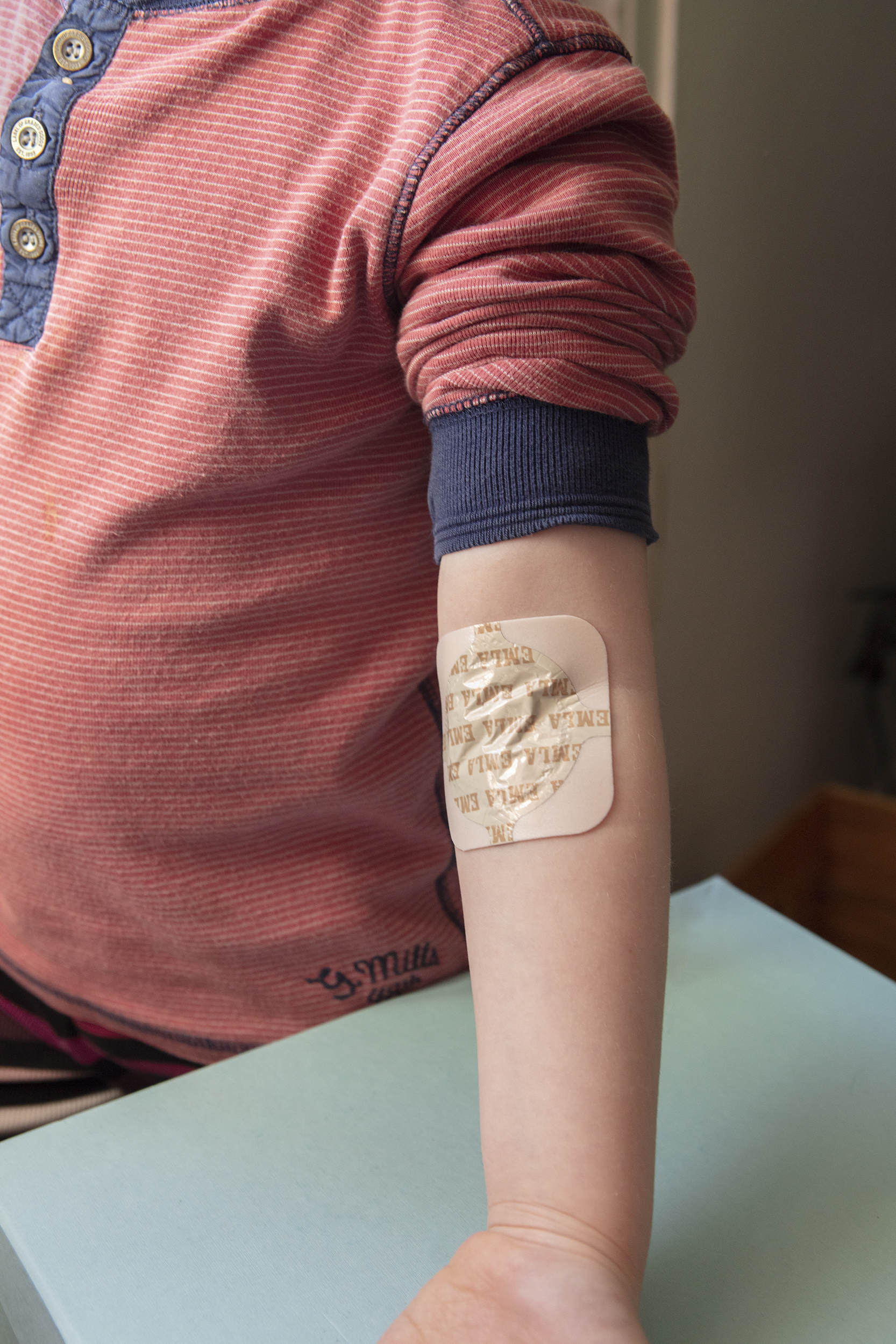 Ett barn har ett bedövningsplåster på ena armvecket.