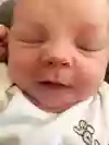 Nyfött barn som har utslag i ansiktet.