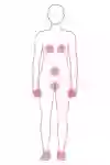 Illustration that shows where on the body the itching usualy occurs.