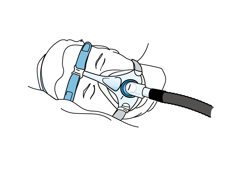 En helmask täcker både näsan och munnen.