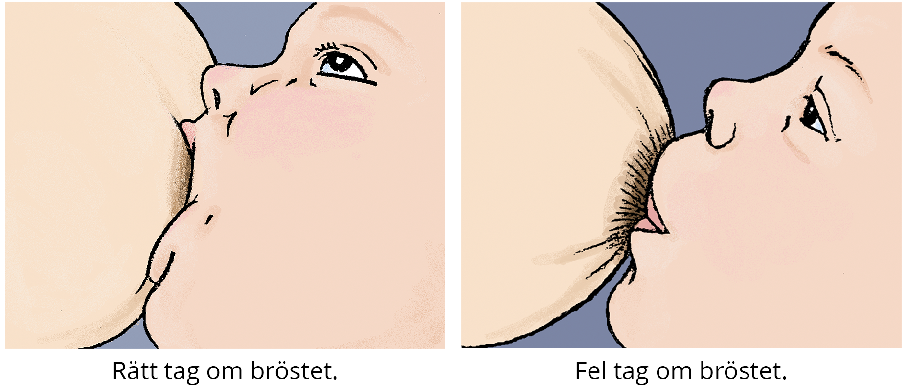 Rätt och fel amningsgrepp. Rätt tag vid amning - bebisen gapar stort och har både bröstvårta och vårtgård i munnen. Fel tag. Bebisen har endast bröstvårtan i munnen.