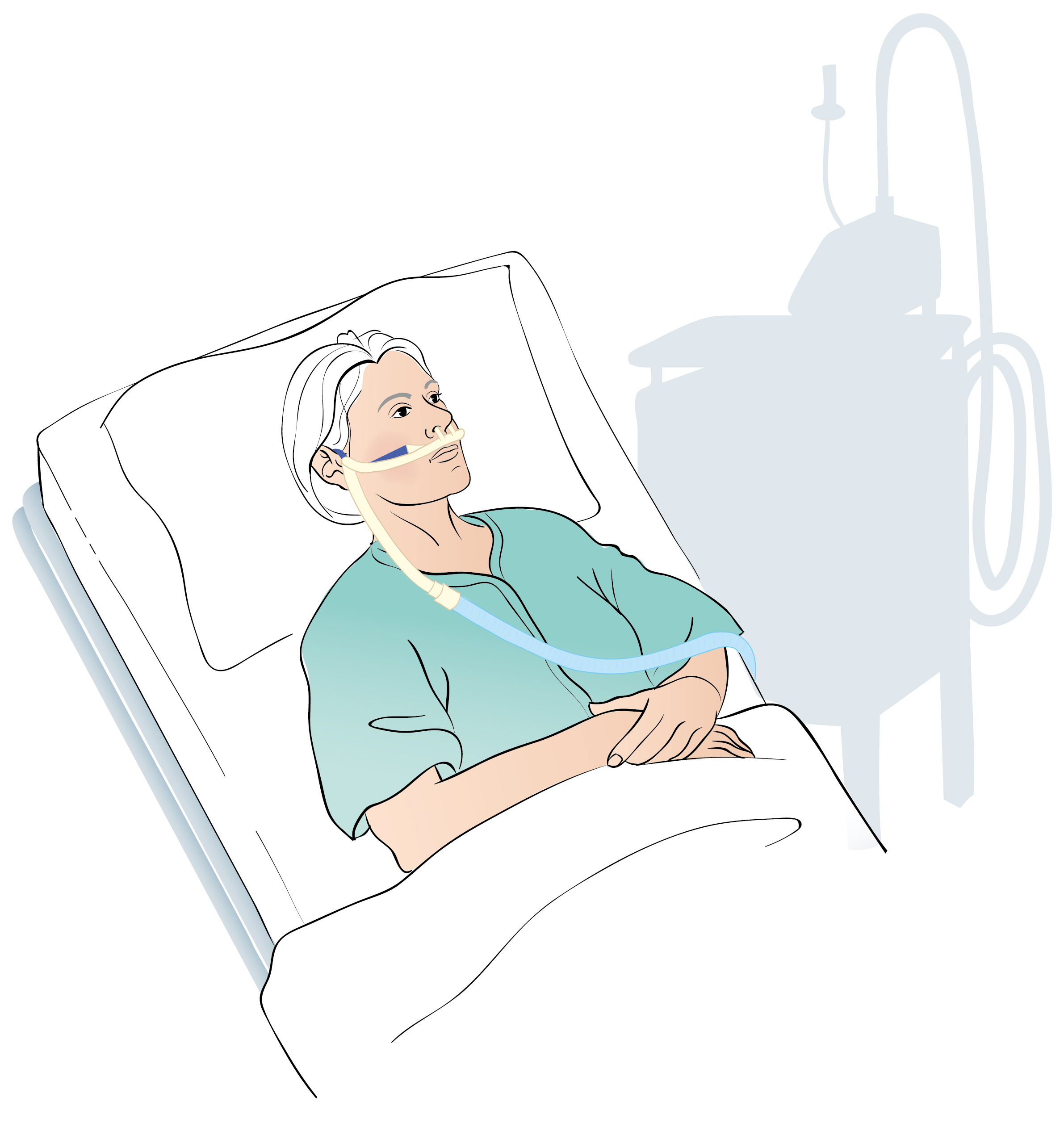 Person som ligger i respirator och andas med hjälp av en högflödesgrimma. Illustration.