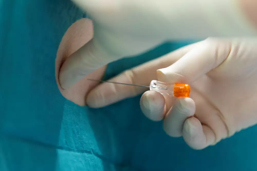 Händer med nål som ska sättas i ryggen i samband med en behandling.