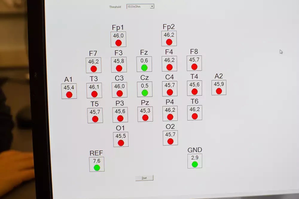 Display med gröna och röda lampor, siffror och bokstäver som används vid undersökning med sömn-EEG.
