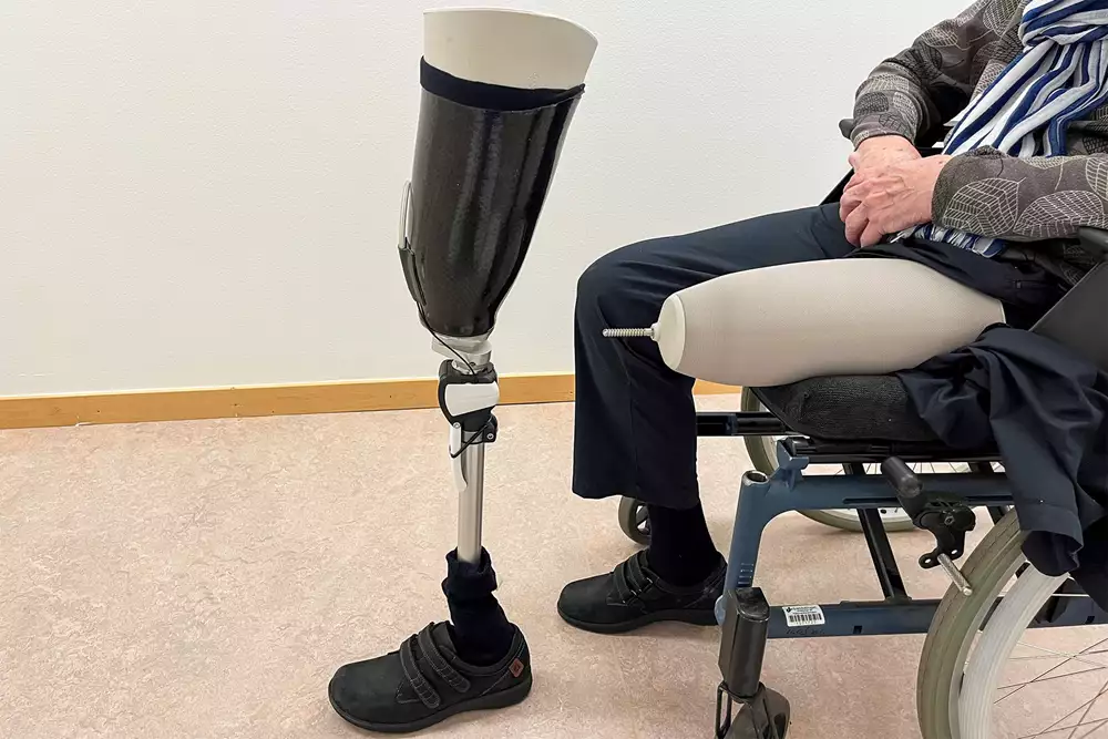 Bild på en person som sitter i en rullstol med en benprotes framför sig.