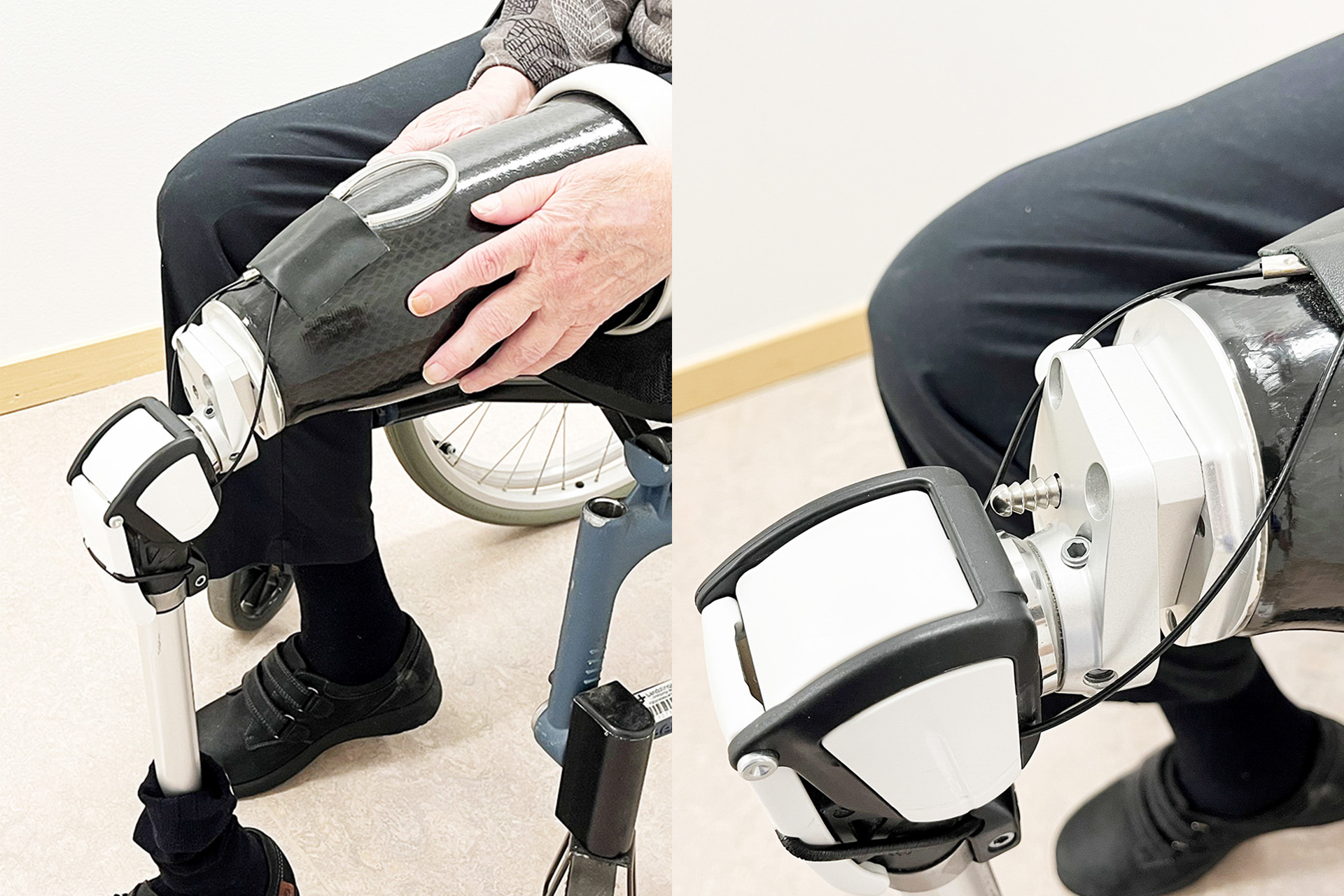 Två bilder bredvid varandra. På den ena bilden greppar en person protesen med händerna och trär den över stumpen. Den andra bilden är inzoomad och visar  pinnen ska hamna i hålet.