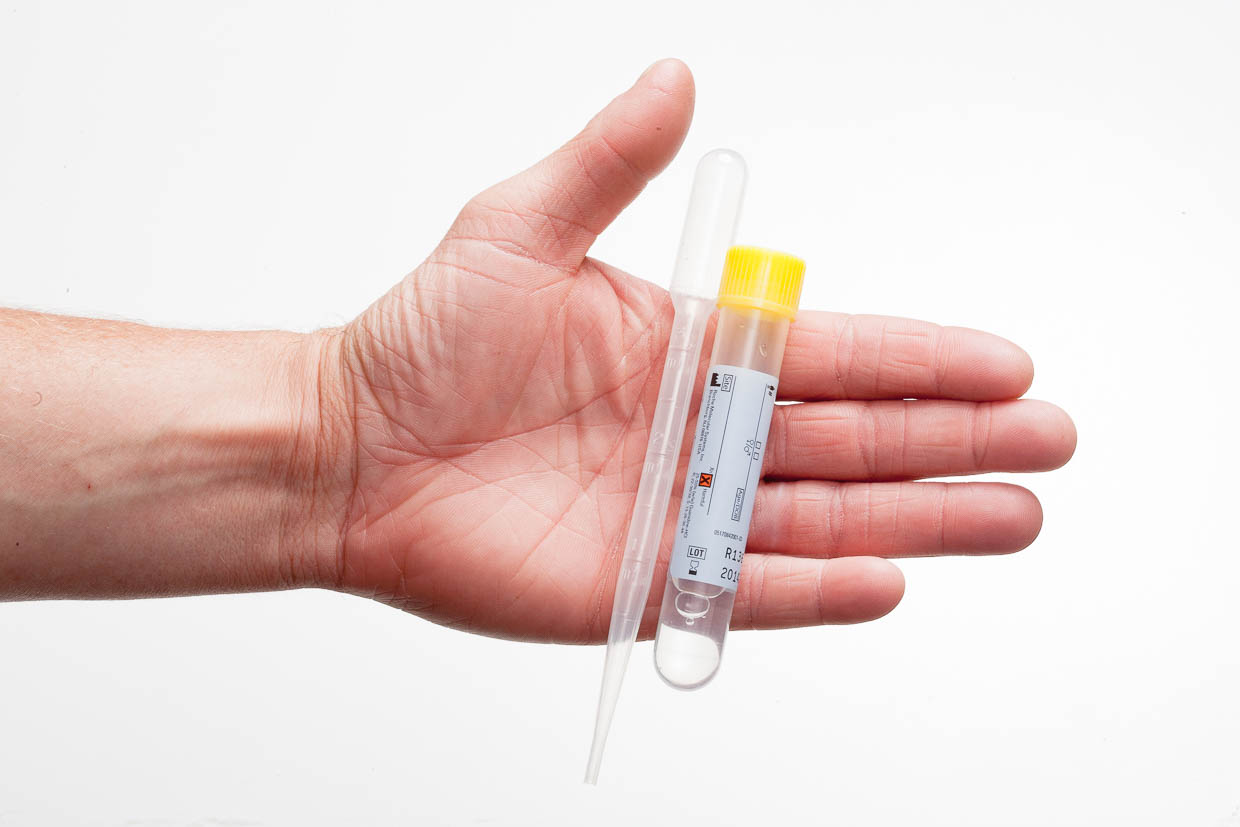 En hand som håller i ett teströr och en pipett.