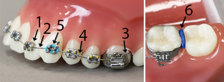 Tandställningens olika delar