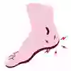 En illustration av en fot som visar på en häl som gör ont. 