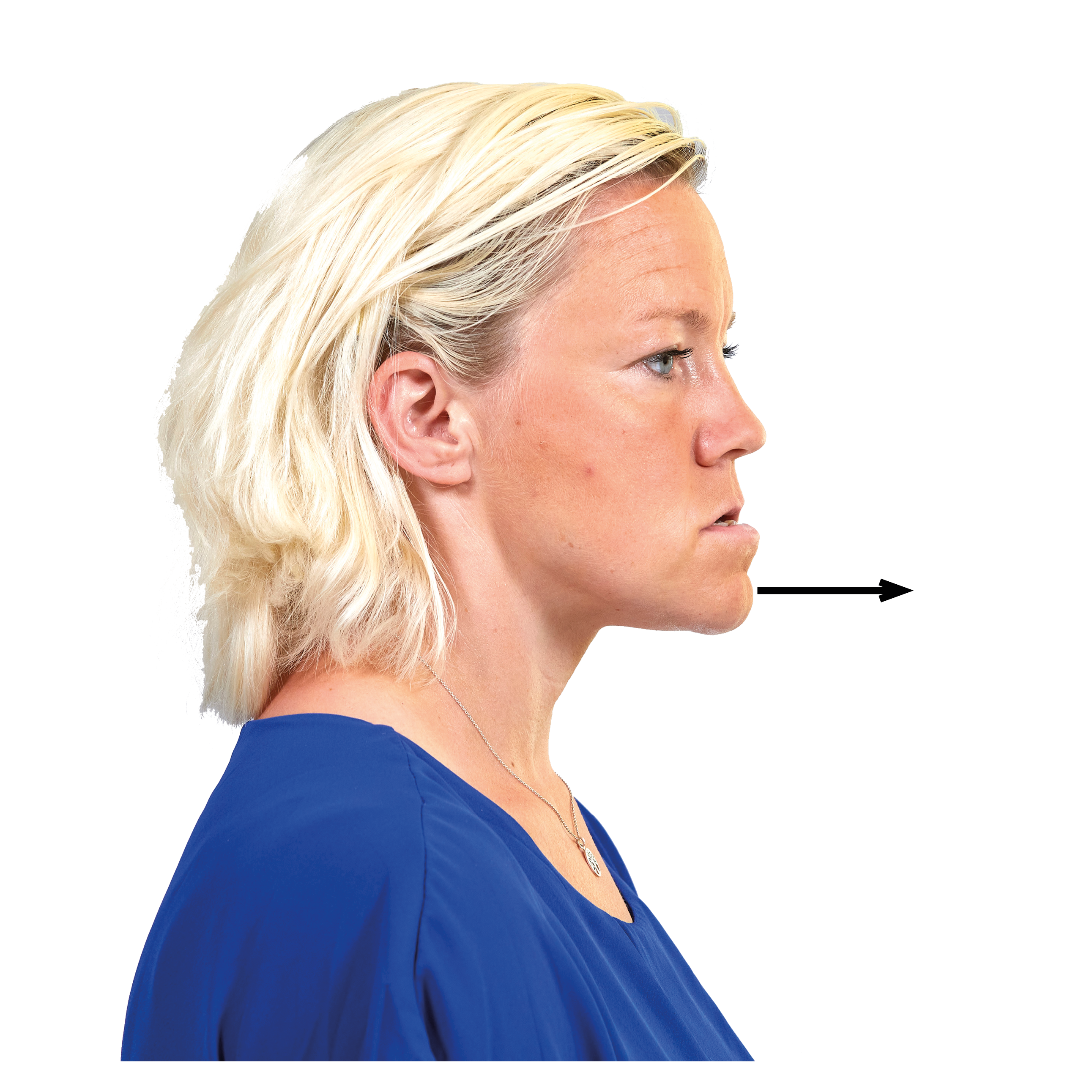 Kvinna i profil skjuter fram underkäke. 