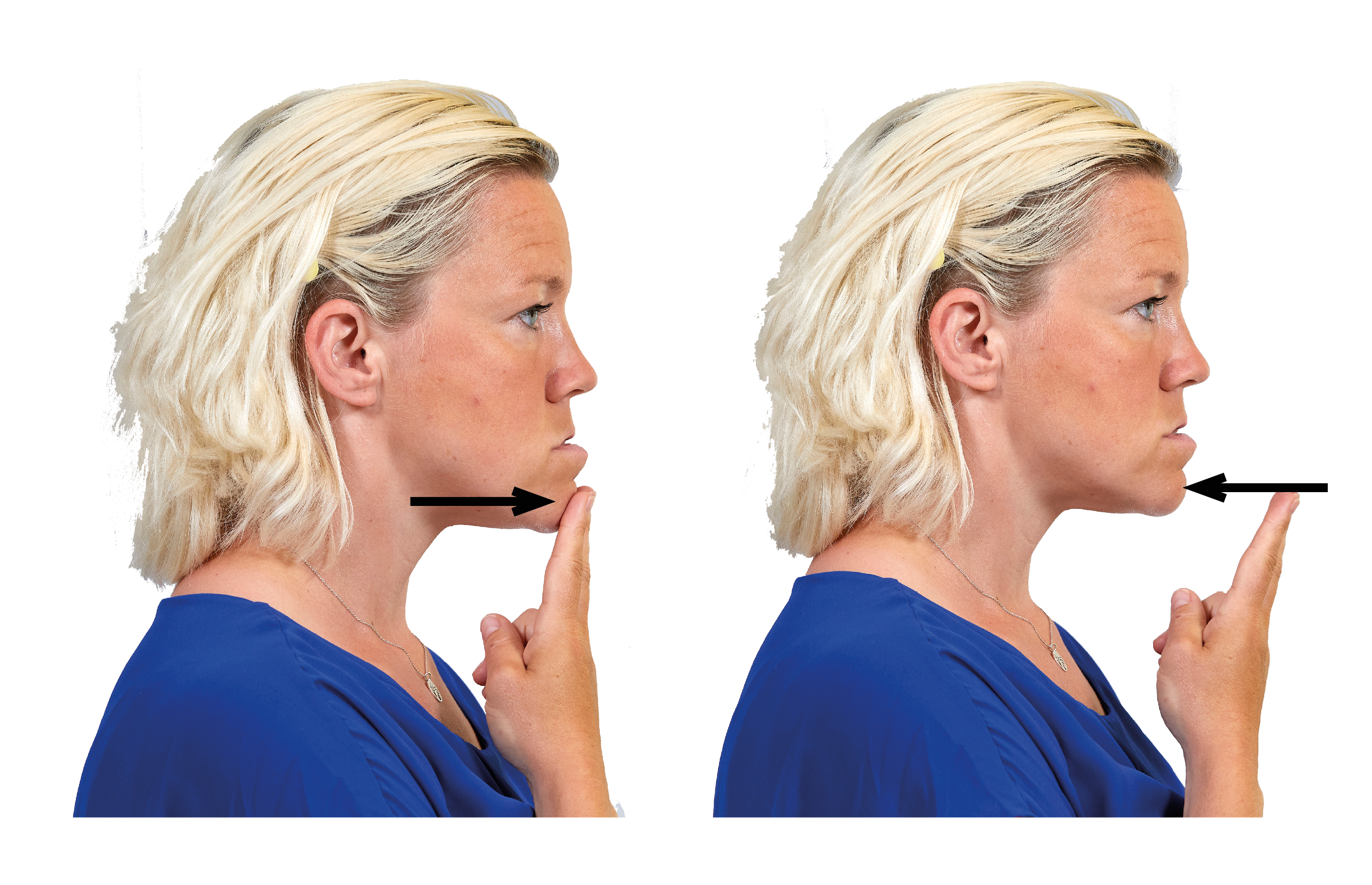 Kvinna i profil håller två fingrar mot hakans framsida. 