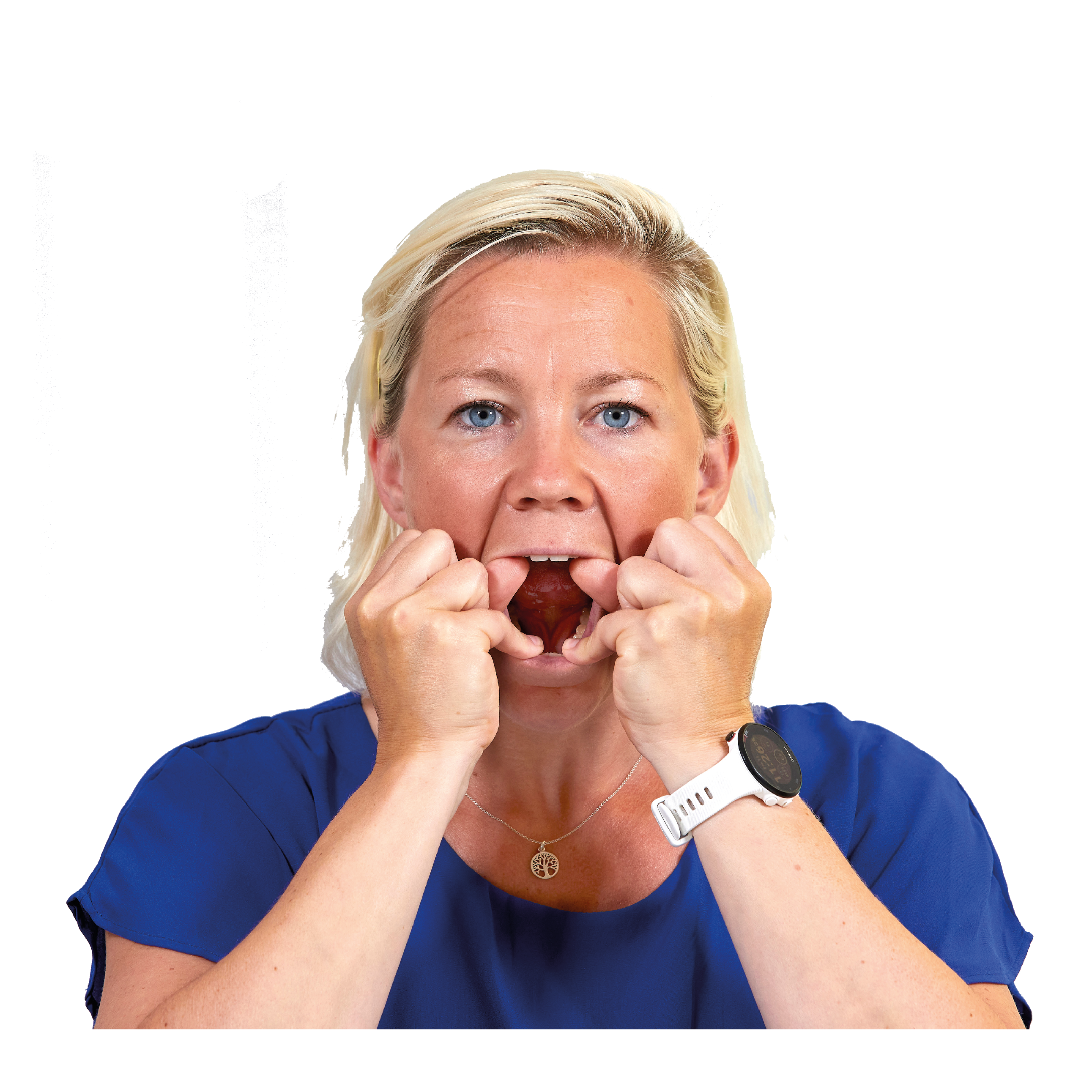 Kvinna gapar stort och håller två tummar mot övre framtänderna och två mot undre framtänderna.