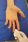 Ett finger tvättas rent