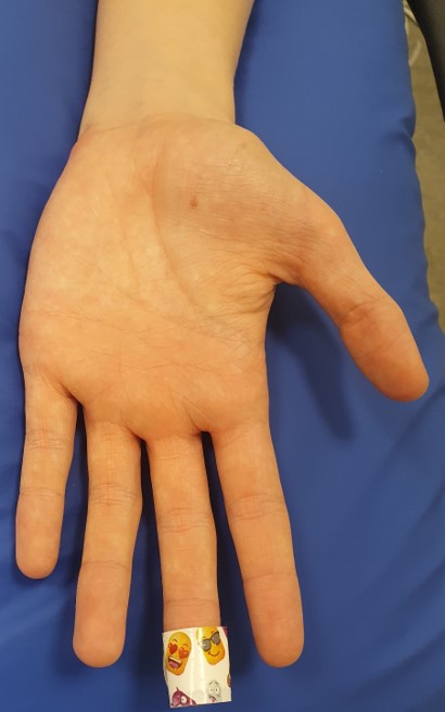 Plåster på finger