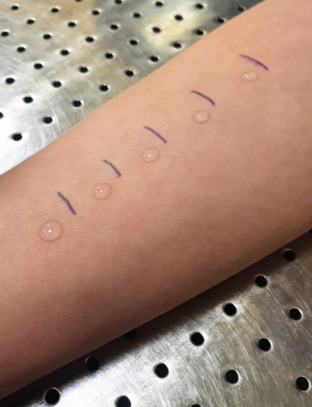 Droppar vid varje streck på armen