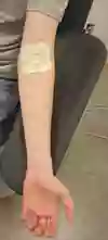 Bedövningsplåster på armen