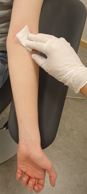 Det bedövade området tvättas rent