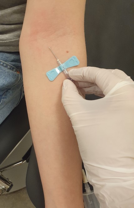 Fjärilsnålen förs in i ett blodkärl