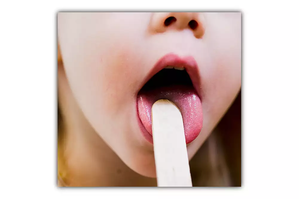 Träspatel som håller nere tungan vid undersökning i barnhälsovården.